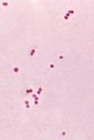 Neisseria meningitidis / Bron: Dr. Brodsky. Modified by Mikael Häggström, Wikimedia Commons (Publiek domein)