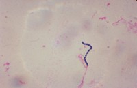 Streptococcus / Bron: Publiek domein, Wikimedia Commons (PD)