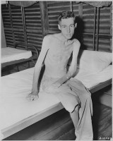 Krijgsgevangene die spierverlies vertoont als gevolg van ondervoeding / Bron: National Archives and Records Administration, Wikimedia Commons (Publiek domein)
