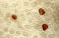 Insluitsels van Chlamydia trachomatis / Bron: User Marcus007 on de.wikipedia, Wikimedia Commons (Publiek domein)