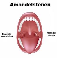 Amandelstenen / Bron: Alila Medical Media/Shutterstock.com