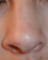 Menselijke neus (zonder zwelling) / Bron: Publiek domein, Wikimedia Commons (PD)