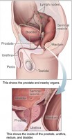 prostatitis betegség hogyan kell meghatározni)