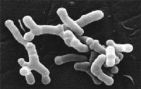 Bifidobacterium longum / Bron: Julie6301, Wikimedia Commons (CC BY-SA-3.0)
