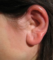 Wondroos in het oor / Bron: Evanherk, Wikimedia Commons (CC BY-SA-3.0)