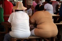 Overgewicht en obesitas zijn risicofactoren van een vaginaverzakking / Bron: Yves Picq, Wikimedia Commons (CC BY-SA-3.0)