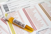 Urineonderzoek bij vermoeden van een nierfilterontsteking / Bron: Angellodeco/Shutterstock