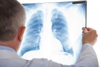 Pijn op de longen kent meerdere oorzaken / Bron: Minerva Studio/Shutterstock.com