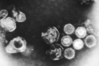 Epstein-Barr-virus (EBV) / Bron: Linda Bartlett (Photographer), Wikimedia Commons (Publiek domein)
