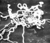 Treponema pallidum is de bacterie die syfilis veroorzaakt / Bron: CDC Dr. David Cox, Wikimedia Commons (Publiek domein)