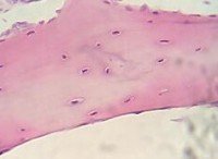 Kraakbeen onder een microscoop gezien / Bron: Fanny CASTETS, Wikimedia Commons (CC BY-2.5)