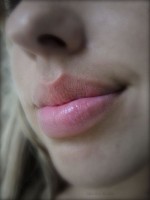 Gezonde lippen / Bron: Gilberto Santa Rosa, Wikimedia Commons (CC BY-2.0)