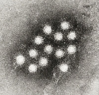 Hepatitis A-virus / Bron: CDC Betty Partin, Wikimedia Commons (Publiek domein)
