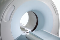 CT-scan bij schildklierkanker / Bron: IStock.com/Pavel Losevsky