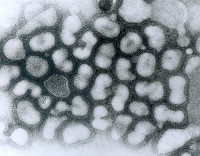 Griep of influenza / Bron: Photo Credit: Content Providers(s): CDC Dr. Erskine Palmer, Wikimedia Commons (Publiek domein)