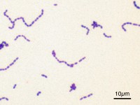 Streptococcus mutans / Bron: Y tambe, Wikimedia Commons (CC BY-SA-3.0)