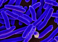 E. coli is een bacterie die van nature voorkomt in de darmen van mensen / Bron: NIAID, Wikimedia Commons (CC BY-2.0)