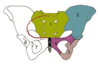 Skelet van het bekken, vooraanzicht<BR>
1=heiligbeen os sacrum, 2=darmbeen os ilium, 3=zitbeen os ischii, 4=schaambeen os pubis (4a=corpus, 4b=ramus superior (richting hoofd), 4c=ramus inferior (aan staartzijde), 4d=tuberculum pubicum), 5=symfyse (schaambeensvoeg), 6=heupkom, 7=foramen obturatum, 8=staartbeen, rode stippellijn= linea terminalis / Bron: Wiechers at Dutch Wikipedia, Wikimedia Commons (CC BY-SA-3.0)