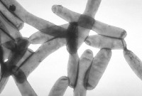 Legionella Pneumophila / Bron: CDC (PHIL #1187), Wikimedia Commons (Publiek domein)