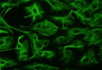 Astrocyten in een celkweek / Bron: Publiek domein, Wikimedia Commons (PD)