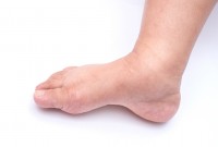 Zwelling van de enkels en voeten tijdens zwangerschap / Bron: Haripat Jantawalee/Shutterstock.com