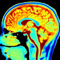 Bewegen is goed voor je hersenen / Bron: BiomedNMR, Wikimedia Commons (CC BY-SA-4.0)