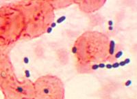 Abnormaal sputum (met een bacterie) / Bron: Photo Credit: Content Providers(s): CDCDr. Mike Miller, Wikimedia Commons (Publiek domein)