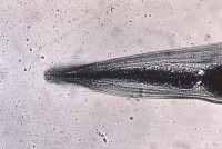 Enterobius vermicularis / Bron: Onbekend, Wikimedia Commons (Publiek domein)