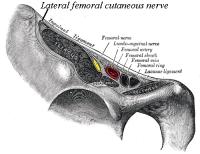 Nervus cutaneus femoris lateralis en andere structuren lopend onder het linker ligamentum inguinale en het os ilium (frontolateraal aanzicht). / Bron: Dan Hoey, Wikimedia Commons (Publiek domein)