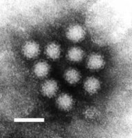 Norovirus, lengtemaat is 50 nm,foto FP Williams, EPA, US / Bron: Publiek domein, Wikimedia Commons (PD)